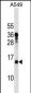 MRPL11 Antibody (N-term)