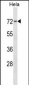 PRKCSH Antibody (N-term)