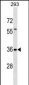 TFG Antibody (Center)