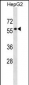 KPNA5 Antibody (N-term)