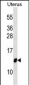 TIMM10 Antibody (Center)
