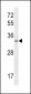 TIGAR Antibody (N-term)