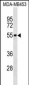 IL5RA Antibody (C-term)