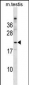 Mouse BAD Antibody (Center S134)