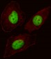 AP19255b-FOXN3-Antibody-C-term