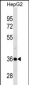 PSMD14 Antibody (C-term)