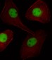 PGR/PR Antibody (C-term)