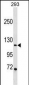 PGR/PR Antibody (C-term)