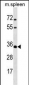 MSX1 Antibody (Center)