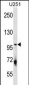 ULK1 Antibody (Center S556)