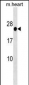 HOXB7 Antibody (Center)