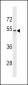 FCGRT Antibody (C-term)