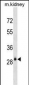 AQP3 Antibody (Center)