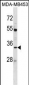 AQP3 Antibody (Center)