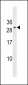 RNF223 Antibody (Center)