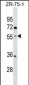 ENTPD5 Antibody (C-term)