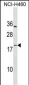PF4V1 Antibody (C-term)