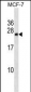 BNIP1 Antibody (N-term)