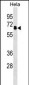 PPP2R5D Antibody (N-term)