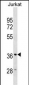 HMOX2 Antibody (N-term)