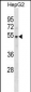 PKNOX1 Antibody (C-term)