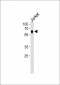 NR2C2 Antibody (C-term)