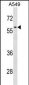 RCC2 Antibody (Center)