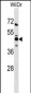 NMI Antibody (N-term)