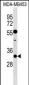 KCNIP2 Antibody (N-term)