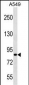 PASD1 Antibody (Center)