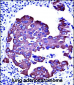 CYK18 Antibody (C-term)