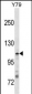 JMY Antibody(N-term)