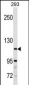 SH3BP4 Antibody(Center)