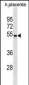 CCKAR Antibody(Center)