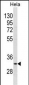 BRMS1 Antibody(N-term)