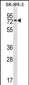 MBD4 Antibody(Center)