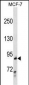 RALBP1 Antibody(N-term)