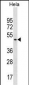 SF3B4 Antibody(Center)