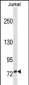 ZNF274 Antibody(N-term)