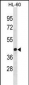 EVX1 Antibody(Center)