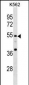 EIF3E Antibody(Center)