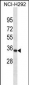 PRRX1 Antibody(C-term)