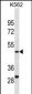 DHODH Antibody(Center)