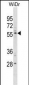 PLXDC1 Antibody(C-term)