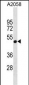 GNA11 Antibody(N-term)