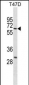 DDX41 Antibody(N-term)