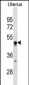 TIMD4 Antibody(C-term)