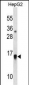 GMFB  Antibody (Center)