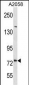 DNER Antibody(C-term)