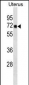 TRMT1 Antibody(N-term)